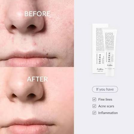 345 Relief Cream